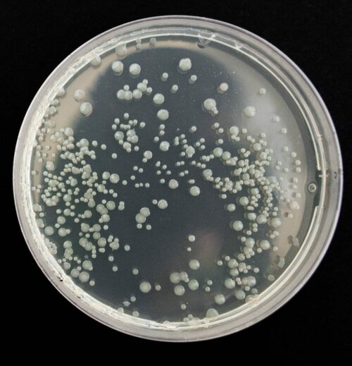 TSA-bakteeri- ja sädesienitesti
